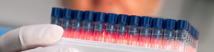 Proben aus der Biobank des IPA.