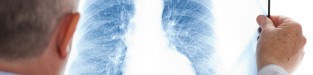 Ein Arzt betrachte ein Röntgenbild einer Lunge.